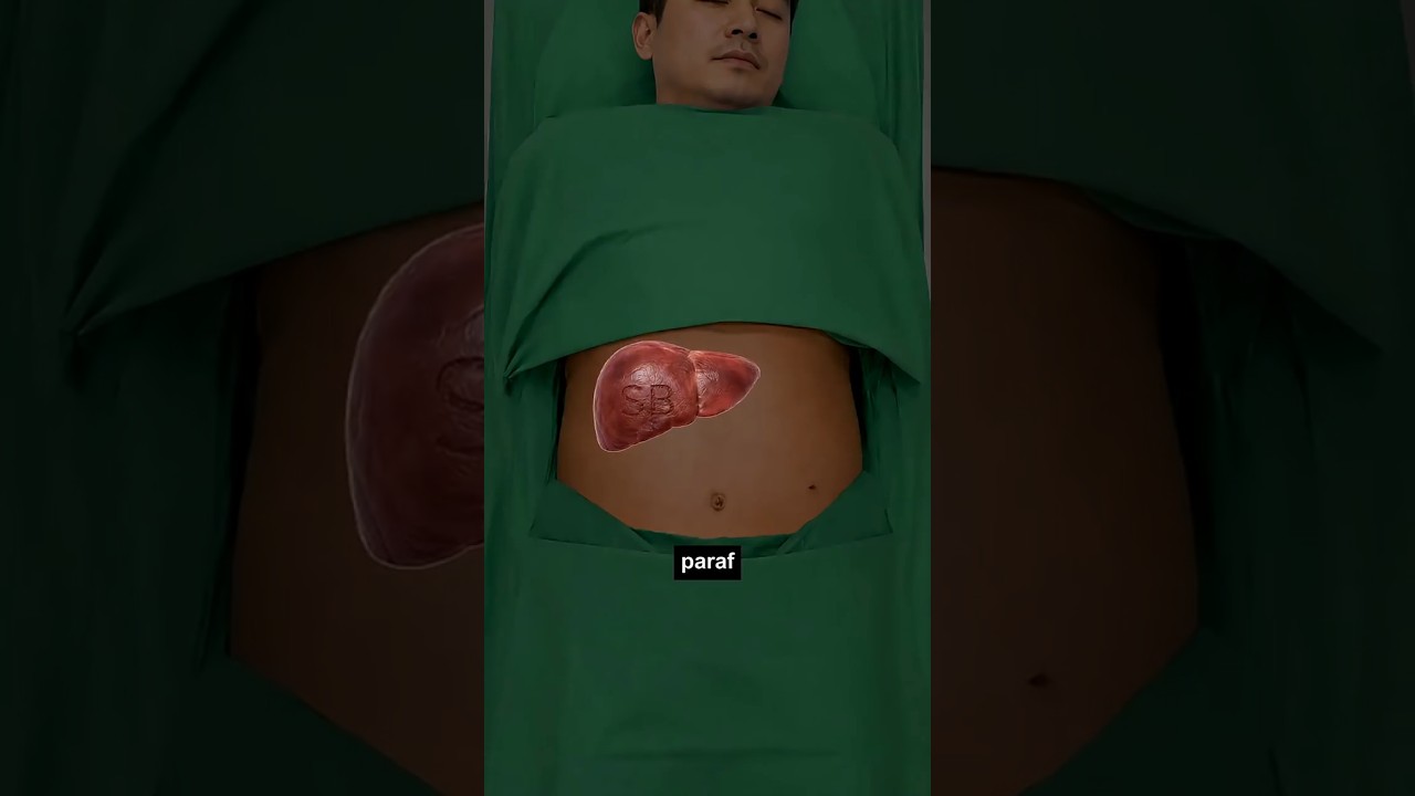 Hal teraneh di ruang operasi...